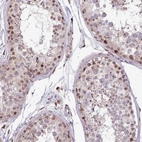 Immunohistochemical staining of human testis shows moderate nuclear positivity in cells in seminiferous ducts.