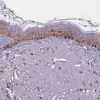 Immunohistochemical staining of human skin shows moderate to strong nuclear positivity in squamous epithelial cells.