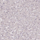 Immunohistochemical staining of human liver shows no positivity in hepatocytes as expected.