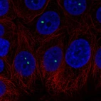 Immunofluorescent staining of human cell line MCF7 shows localization to nuclear bodies.