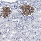 Anti-TAS2R1 Antibody