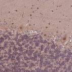 Anti-KCTD11 Antibody