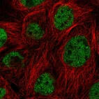 Immunofluorescent staining of human cell line A-431 shows localization to nucleoplasm.