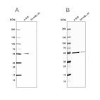 Western blot analysis using Anti-GPI antibody HPA052171 (A) shows similar pattern to independent antibody HPA024305 (B).