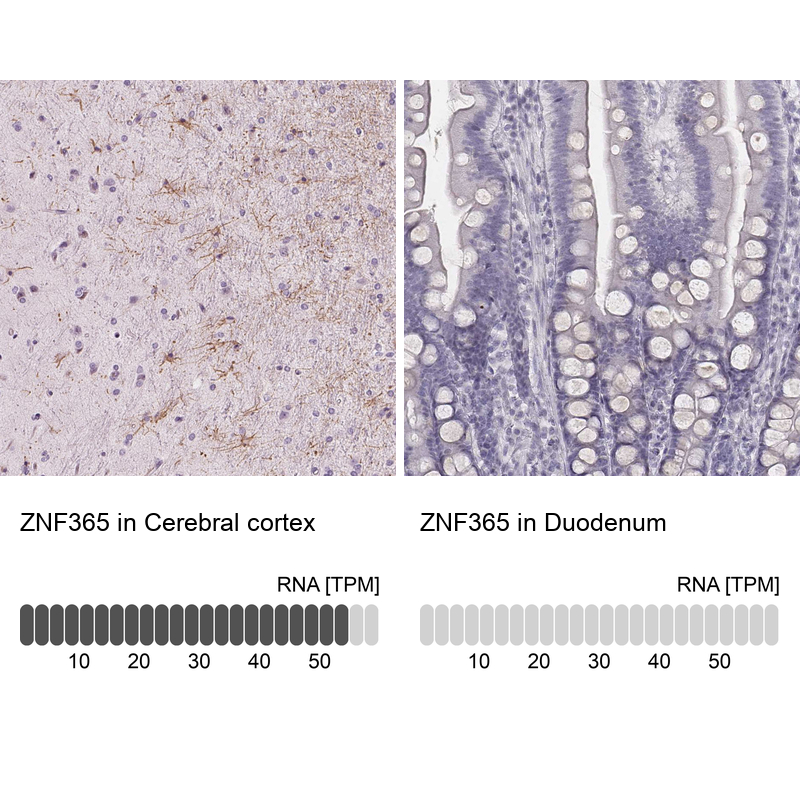 Anti-ZNF365 Antibody