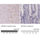 Anti-ZNF365 Antibody