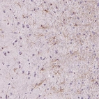 Immunohistochemical staining of human cerebral cortex shows moderate cytoplasmic positivity in glial cells.