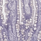 Immunohistochemical staining of human duodenum shows no positivity in glandular cells as expected.
