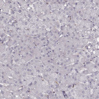 Immunohistochemical staining of human liver shows no positivity in hepatocytes as expected.