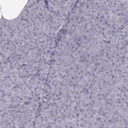 Immunohistochemical staining of human Pancreas shows no positivity in exocrine glandular cells as expected.