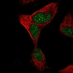 Immunofluorescent staining of human cell line SH-SY5Y shows localization to nucleus.