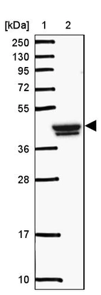 Lane 1: Marker [kDa] 250, 130, 95, 72, 55, 36, 28, 17, 10_br/_Lane 2: Human cell line RT-4