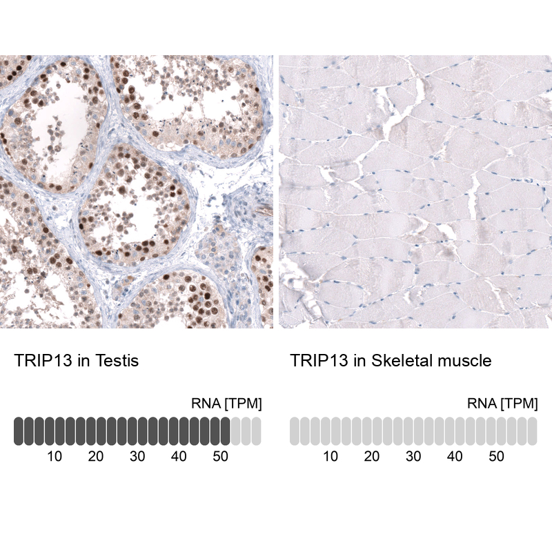 Anti-TRIP13 Antibody