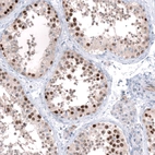 Immunohistochemical staining of human testis shows strong nuclear positivity in cells in seminiferous ducts.