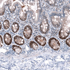 Immunohistochemical staining of human duodenum shows strong nuclear positivity in glandular cells.