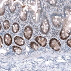 Immunohistochemical staining of human duodenum shows strong nuclear positivity in glandular cells.