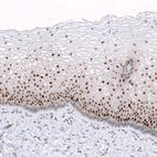 Immunohistochemical staining of human cervix shows strong nuclear positivity in squamous epithelial cells.