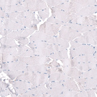 Immunohistochemical staining of human skeletal muscle shows no positivity in myocytes as expected.