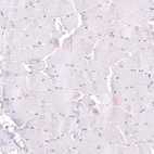 Immunohistochemical staining of human skeletal muscle shows no positivity in myocytes as expected.