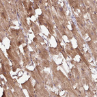 Anti-TIMMDC1 Antibody