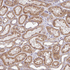 Immunohistochemical staining of human kidney shows moderate granular cytoplasmic positivity in cells in tubules.