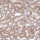 Immunohistochemical staining of human kidney shows moderate granular cytoplasmic positivity in cells in tubules.