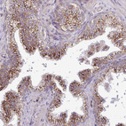 Immunohistochemical staining of human prostate shows strong granular cytoplasmic positivity in glandular cells.