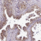 Immunohistochemical staining of human prostate shows strong granular cytoplasmic positivity in glandular cells.