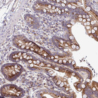 Immunohistochemical staining of human colon shows strong granular cytoplasmic positivity in glandular cells.