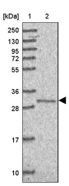 Lane 1: Marker [kDa] 250, 130, 95, 72, 55, 36, 28, 17, 10_br/_Lane 2: Human cell line RT-4