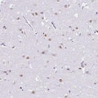 Anti-DCAF17 Antibody