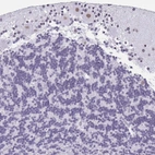 Immunohistochemical staining of human Cerebellum shows moderate nuclear positivity in Purkinje cells.