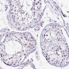 Immunohistochemical staining of human Testis shows weak nuclear positivity in cells in seminiferous ducts.
