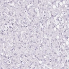 Immunohistochemical staining of human Liver shows very weak nuclear positivity in hepatocytes.