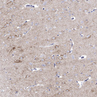 Immunohistochemical staining of human cerebral cortex shows moderate granular cytoplasmic positivity in neurons.