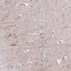 Immunohistochemical staining of human cerebral cortex shows moderate granular cytoplasmic positivity in neurons.