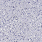 Immunohistochemical staining of human liver shows no positivity in hepatocytes as expected.