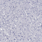 Anti-PDYN Antibody