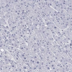 Immunohistochemical staining of human liver shows no positivity in hepatocytes as expected.