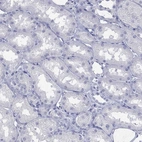 Immunohistochemical staining of human kidney shows no positivity in cells in tubules as expected.