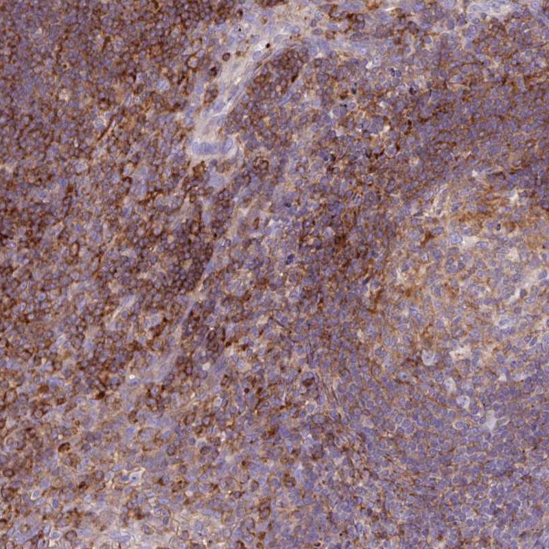 Anti-CORO7 Antibody