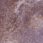 Anti-CORO7 Antibody