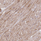 Anti-TRIM55 Antibody