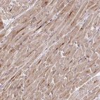 Anti-TRIM55 Antibody