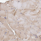 Immunohistochemical staining of human skeletal muscle shows moderate cytoplasmic positivity in myocytes.