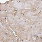 Immunohistochemical staining of human skeletal muscle shows moderate cytoplasmic positivity in myocytes.