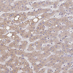 Immunohistochemical staining of human liver shows moderate cytoplasmic positivity in hepatocytes.