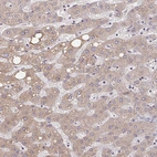 Immunohistochemical staining of human liver shows moderate cytoplasmic positivity in hepatocytes.