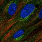 Immunofluorescent staining of human cell line BJ shows localization to cytosol & the Golgi apparatus.
