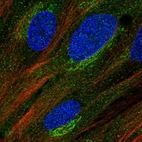 Immunofluorescent staining of human cell line BJ shows localization to cytosol & the Golgi apparatus.